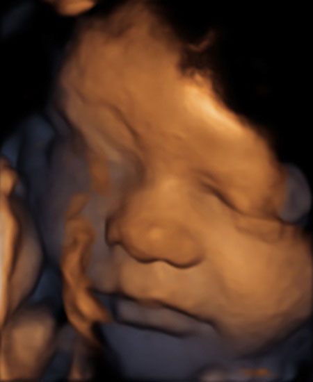 “When I met my unborn child for the first time, everything fell into place. It was real.”