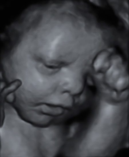 4d ultrasound pictures